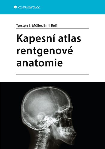 Kniha: Kapesní atlas rentgenové anatomie od Möller Torsten B.