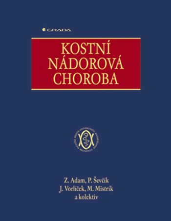 E-kniha: Kostní nádorová choroba od Adam Zdeněk