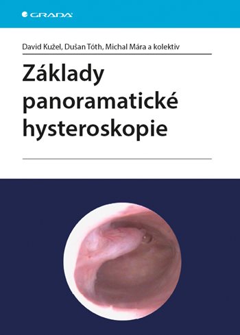 Základy panoramatické hysteroskopie kúpite na Grada.sk