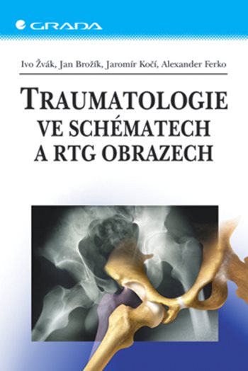 E-kniha: Traumatologie ve schématech a RTG obrazech od Žvák Ivo