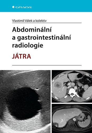 E-kniha: Abdominální a gastrointestinální radiologie od Válek Vlastimil