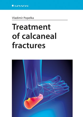 E-kniha: Treatment of calcaneal fractures od Popelka Vladimír