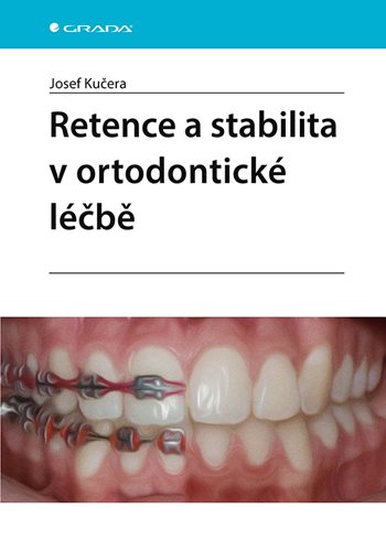 Retence a stabilita v ortodontické léčbě kúpite na Grada.sk