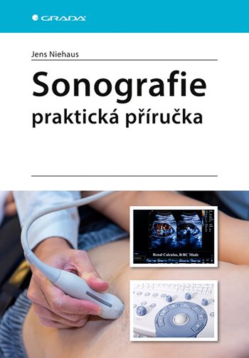 Kniha: Sonografie od Niehaus Jens